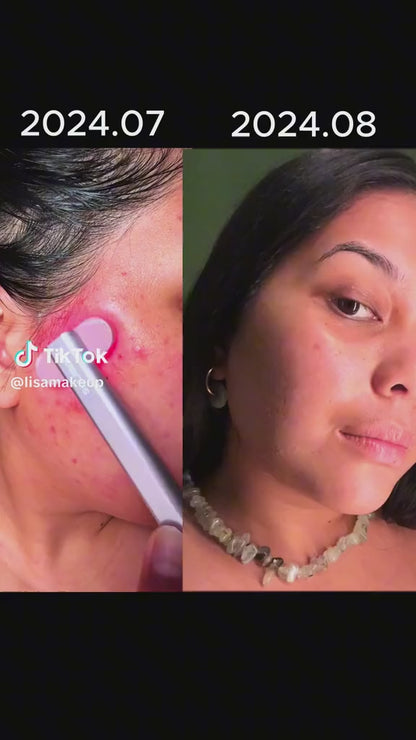 Healyn™ GlowWand